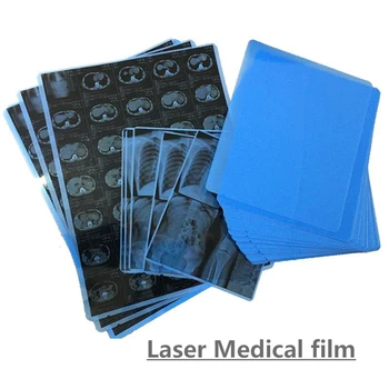 100 Vienetų A4 14*17 Medicinos Rašalinis Sausas Laser X-ray Vaizdo Mėlyna Filmas medicinos prietaisų